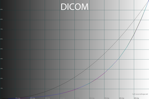 28_dicom_gamma.png
